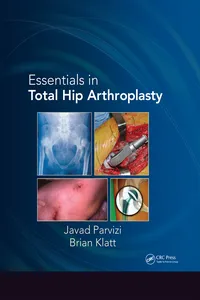Essentials in Total Hip Arthroplasty_cover