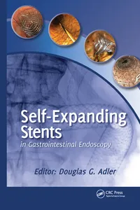 Self-Expanding Stents in Gastrointestinal Endoscopy_cover