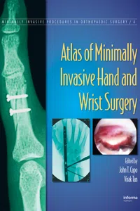 Atlas of Minimally Invasive Hand and Wrist Surgery_cover