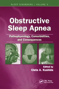 Obstructive Sleep Apnea_cover