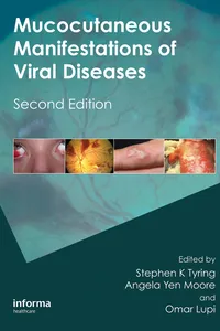 Mucocutaneous Manifestations of Viral Diseases_cover