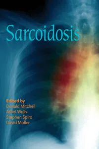 Sarcoidosis_cover