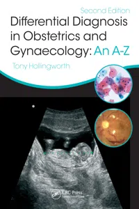 Differential Diagnosis in Obstetrics & Gynaecology_cover