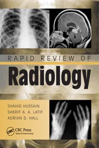 Rapid Review of Radiology_cover
