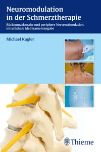 Neuromodulation in der Schmerztherapie_cover