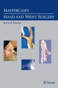 MasterCases in Hand and Wrist Surgery_cover