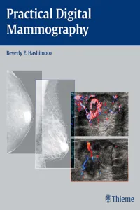 Practical Digital Mammography_cover