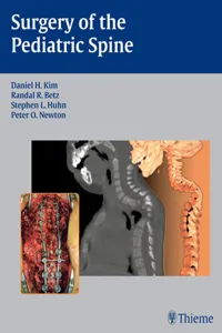 Surgery of the Pediatric Spine_cover