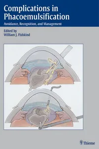 Complications in Phacoemulsification_cover