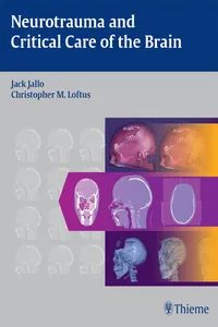 Neurotrauma and Critical Care of the Brain_cover