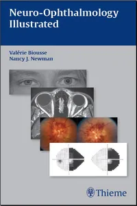 Neuro-Ophthalmology Illustrated_cover