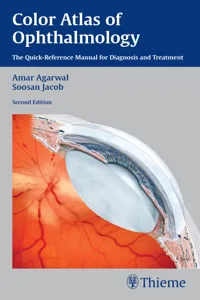 Color Atlas of Ophthalmology_cover