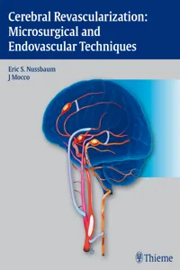 Cerebral Revascularization: Microsurgical and Endovascular Techniques_cover