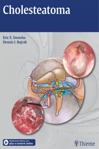 Cholesteatoma_cover