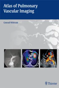 Atlas of Pulmonary Vascular Imaging_cover