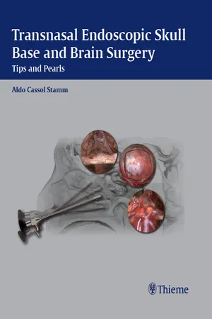 Transnasal Endoscopic Skull Base and Brain Surgery