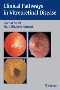 Clinical Pathways In Vitreoretinal Disease_cover