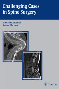 Challenging Cases in Spine Surgery_cover