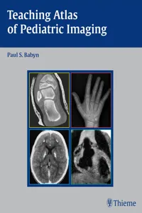 Teaching Atlas of Pediatric Imaging_cover