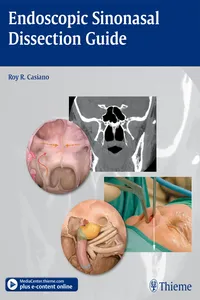 Endoscopic Sinonasal Dissection Guide_cover