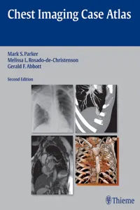 Chest Imaging Case Atlas_cover