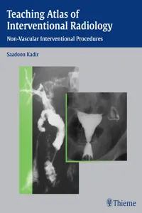 Teaching Atlas of Interventional Radiology_cover