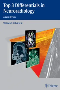 Top 3 Differentials in Neuroradiology_cover