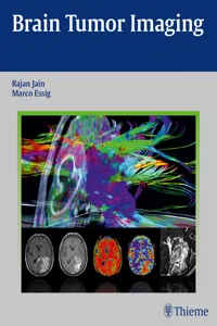 Brain Tumor Imaging_cover