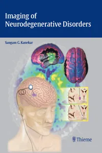 Imaging of Neurodegenerative Disorders_cover