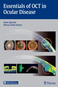 Essentials of OCT in Ocular Disease_cover