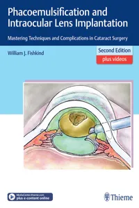 Phacoemulsification and Intraocular Lens Implantation_cover