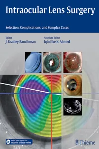 Intraocular Lens Surgery_cover