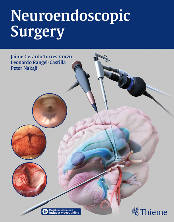 PDF] Neuroendoscopic Surgery by Jaime Torres-Corzo eBook | Perlego
