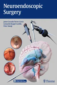 Neuroendoscopic Surgery_cover