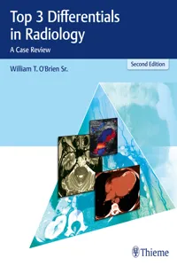 Top 3 Differentials in Radiology_cover