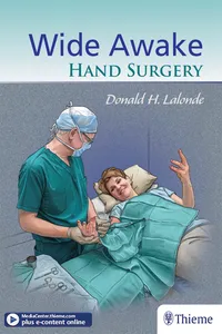 Wide Awake Hand Surgery_cover