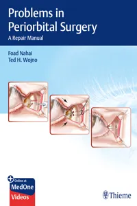 Problems in Periorbital Surgery_cover