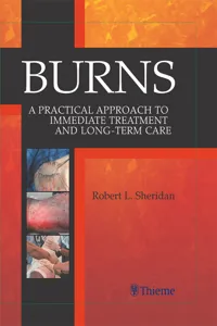 Burns_cover