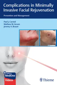 Complications in Minimally Invasive Facial Rejuvenation_cover