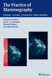 The Practice of Mammography_cover