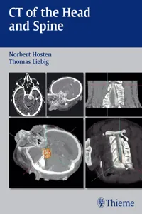 CT of the Head and Spine_cover