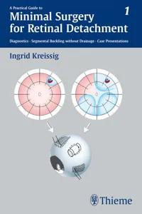 A Practical Guide to Minimal Surgery for Retinal Detachment, Vol. 1_cover