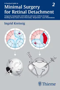 A Practical Guide to Minimal Surgery for Retinal Detachment, Vol. 2_cover