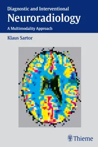 Diagnostic and Interventional Neuroradiology_cover