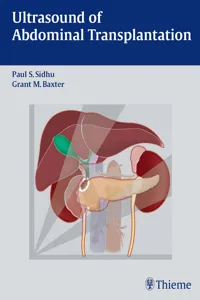 Ultrasound of Abdominal Transplantation_cover