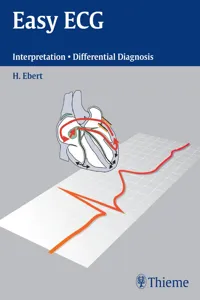 Easy ECG_cover