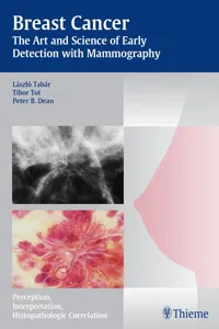 Breast Cancer - The Art and Science of Early Detection with Mammography_cover