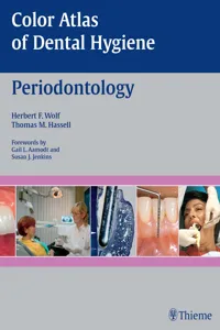 Color Atlas of Dental Hygiene: Periodontology_cover