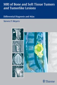 MRI of Bone and Soft Tissue Tumors and Tumorlike Lesions_cover