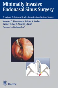 Minimally Invasive Endonasal Sinus Surgery_cover